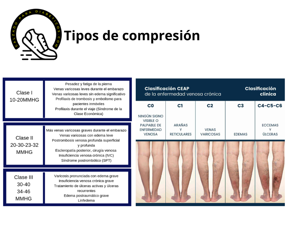 tipos_de_medias de compresion, costa rica , casa medica de pie la uña caminando comodo sigvaris